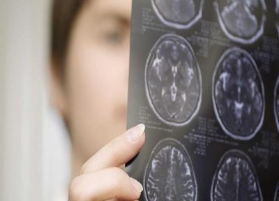 کشف روشی موثر برای درمان یک سرطان مغزی نادر در بچه ها